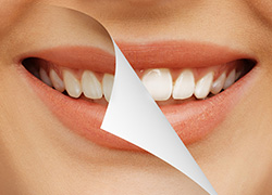 魅力的な輝く白い歯を手に入れるために
